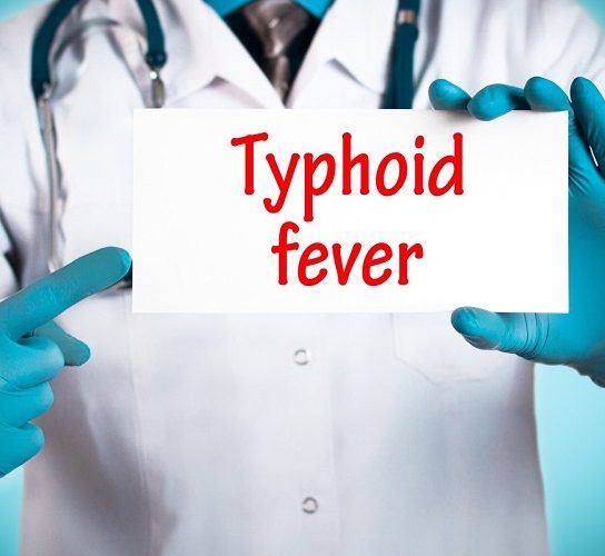 Comprehensive Guide to Typhoid Fever