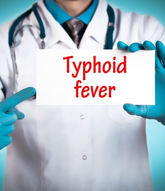 Comprehensive Guide to Typhoid Fever